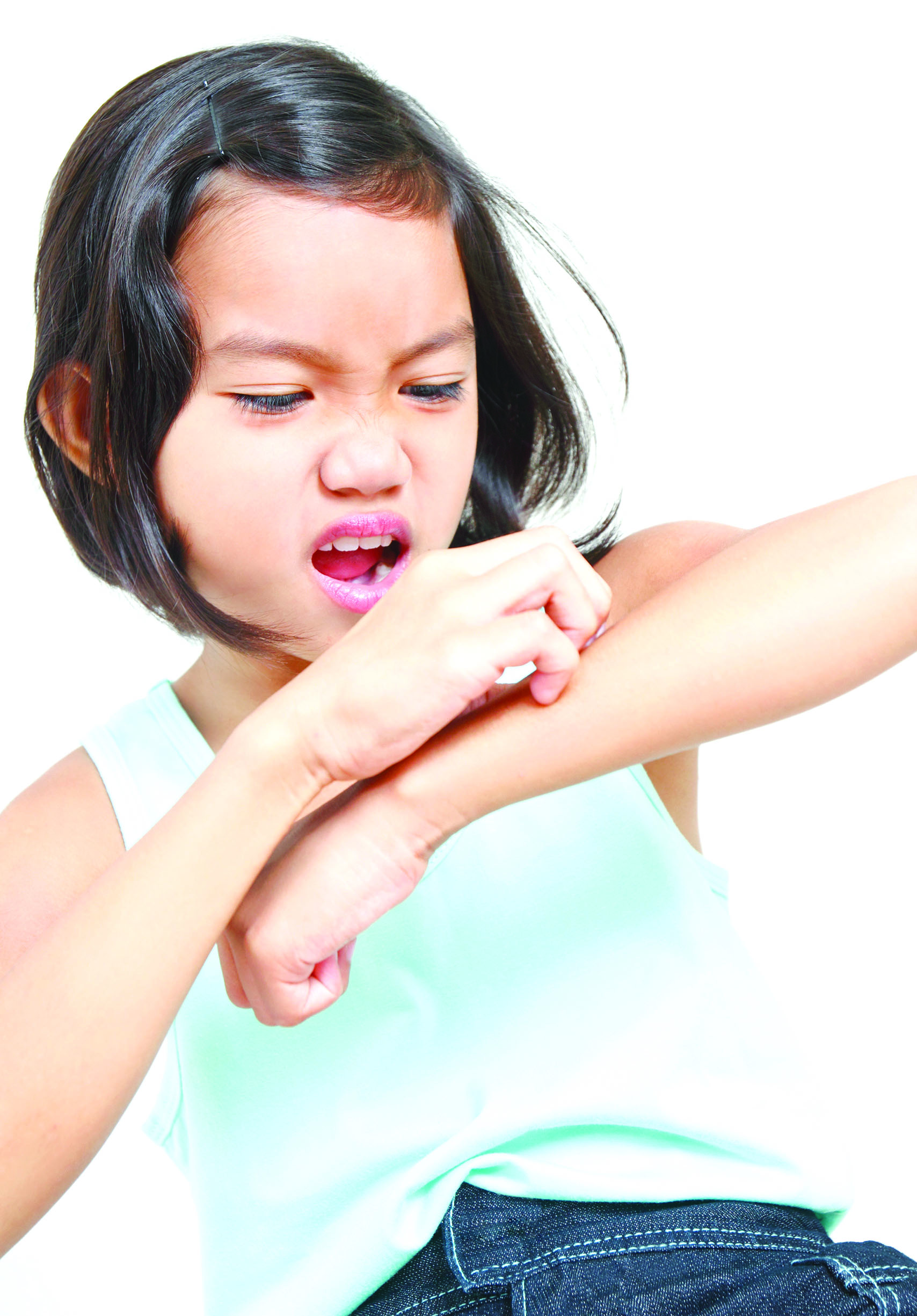 Portrait,Of,A,Young,Asian,Girl,Scratching,Her,Arm.