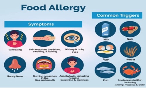 Food Allergy